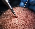 Implantación
